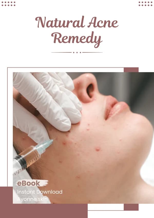 Natural Acne Remedy